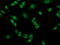 Phosphoglycerate Mutase 2 antibody, M10014, Boster Biological Technology, Immunofluorescence image 