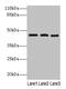 Branched Chain Amino Acid Transaminase 2 antibody, CSB-PA002601LA01HU, Cusabio, Western Blot image 