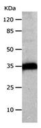 Cathepsin Z antibody, orb107361, Biorbyt, Western Blot image 
