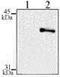 NFKB Inhibitor Alpha antibody, TA336464, Origene, Western Blot image 