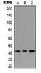 Cathepsin W antibody, LS-C354306, Lifespan Biosciences, Western Blot image 