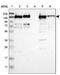 Fibronectin Type III Domain Containing 3A antibody, PA5-52630, Invitrogen Antibodies, Western Blot image 