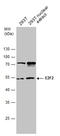 E2F Transcription Factor 2 antibody, GTX130030, GeneTex, Western Blot image 