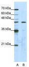 Obg-like ATPase 1 antibody, TA343793, Origene, Western Blot image 
