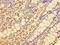 Elongation of very long chain fatty acids protein 1 antibody, LS-C380091, Lifespan Biosciences, Immunohistochemistry paraffin image 