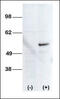 STK38L antibody, 63-172, ProSci, Western Blot image 