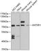 ANTXR Cell Adhesion Molecule 1 antibody, GTX64680, GeneTex, Western Blot image 