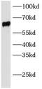 Solute carrier family 22 member 6 antibody, FNab10141, FineTest, Western Blot image 