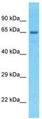 EF-Hand Domain Containing 1 antibody, TA335884, Origene, Western Blot image 