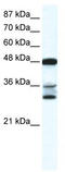 TNF Superfamily Member 10 antibody, TA330336, Origene, Western Blot image 