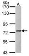 Protein Arginine Methyltransferase 5 antibody, GTX115994, GeneTex, Western Blot image 