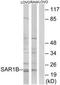 Secretion Associated Ras Related GTPase 1B antibody, TA312375, Origene, Western Blot image 