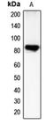 CHM Like Rab Escort Protein antibody, orb213737, Biorbyt, Western Blot image 