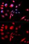 Kinesin-like protein KIF2C antibody, GTX33307, GeneTex, Immunofluorescence image 