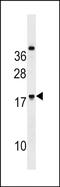 Ring Finger Protein 224 antibody, PA5-72105, Invitrogen Antibodies, Western Blot image 