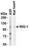 DExD/H-Box Helicase 58 antibody, GTX85488, GeneTex, Western Blot image 