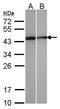 Selenophosphate Synthetase 1 antibody, PA5-21837, Invitrogen Antibodies, Western Blot image 