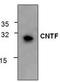 Ciliary Neurotrophic Factor antibody, TA319020, Origene, Western Blot image 