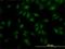Serine/threonine-protein kinase MAK antibody, H00004117-M02, Novus Biologicals, Immunofluorescence image 