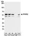 6-Phosphofructo-2-Kinase/Fructose-2,6-Biphosphatase 2 antibody, NBP2-32194, Novus Biologicals, Western Blot image 