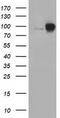 Catenin Beta 1 antibody, TA502303, Origene, Western Blot image 