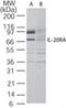 Interleukin 20 Receptor Subunit Alpha antibody, TA336352, Origene, Western Blot image 