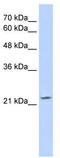 Putative transcription factor Ovo-like 1 antibody, TA343477, Origene, Western Blot image 