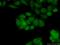 Serum Response Factor antibody, 16821-1-AP, Proteintech Group, Immunofluorescence image 