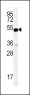 SLC9A3 Regulator 1 antibody, 62-072, ProSci, Western Blot image 