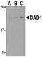 Defender Against Cell Death 1 antibody, TA306165, Origene, Western Blot image 