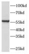 Phosphoglycerate Dehydrogenase antibody, FNab06389, FineTest, Western Blot image 