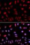 Checkpoint protein HUS1 antibody, LS-C334043, Lifespan Biosciences, Immunofluorescence image 