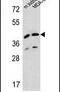 L-2-Hydroxyglutarate Dehydrogenase antibody, PA5-23760, Invitrogen Antibodies, Western Blot image 
