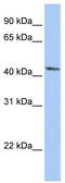 Insulin Like Growth Factor Binding Protein 2 antibody, TA336226, Origene, Western Blot image 