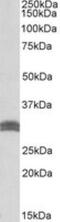 Carbonyl Reductase 1 antibody, NB100-1066, Novus Biologicals, Western Blot image 
