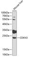 Cyclin-dependent kinase inhibitor 3 antibody, GTX55567, GeneTex, Western Blot image 