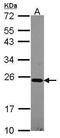 NADH:Ubiquinone Oxidoreductase Subunit B10 antibody, PA5-30100, Invitrogen Antibodies, Western Blot image 