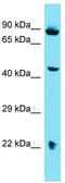 Armadillo Like Helical Domain Containing 1 antibody, TA334859, Origene, Western Blot image 