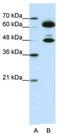 Small Nuclear Ribonucleoprotein U1 Subunit 70 antibody, TA345824, Origene, Western Blot image 