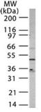C-X-C Motif Chemokine Receptor 4 antibody, GTX13854, GeneTex, Western Blot image 