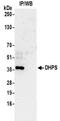 Deoxyhypusine synthase antibody, NBP2-32256, Novus Biologicals, Immunoprecipitation image 