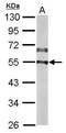 Calcium/Calmodulin Dependent Protein Kinase II Delta antibody, TA308736, Origene, Western Blot image 