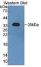 Serum antibody, MBS2028185, MyBioSource, Western Blot image 