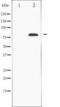 Tumor Protein P73 antibody, TA325958, Origene, Western Blot image 