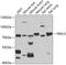 F-Box And Leucine Rich Repeat Protein 5 antibody, GTX32599, GeneTex, Western Blot image 
