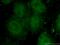 DNA Ligase 4 antibody, 66705-1-Ig, Proteintech Group, Immunofluorescence image 