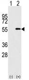 Nucleoporin 50 antibody, AP11702PU-N, Origene, Western Blot image 