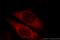 CLINT1 antibody, 10470-1-AP, Proteintech Group, Immunofluorescence image 