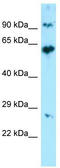 Keratin 71 antibody, TA337946, Origene, Western Blot image 