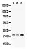 Ribosomal Protein L19 antibody, PA5-79935, Invitrogen Antibodies, Western Blot image 